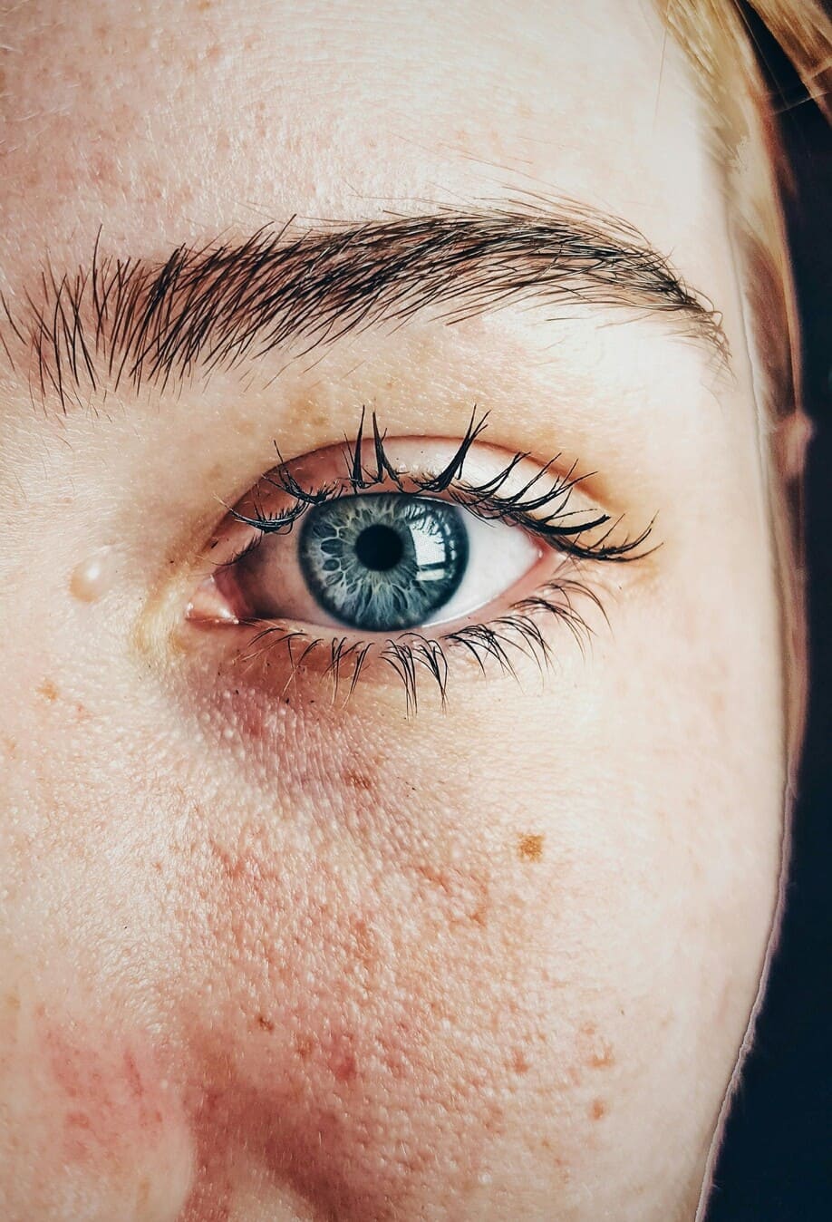 close na parte lateral do rosto de uma mulher com a pele sensível